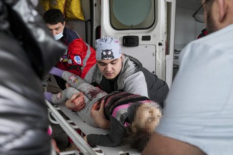 Лікарі не змогли врятувати поранених дітей, які постраждали від російської агресії.